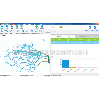 根系分析系统 根系分析系统